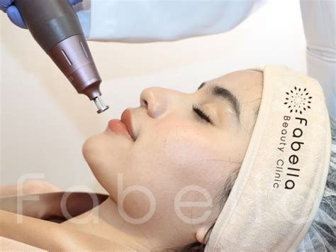 7 Cara Ampuh Treatment Menghilangkan Komedo dalam 1 Minggu! 7 Cara Ampuh Treatment Menghilangkan Komedo dalam 1 Minggu!
