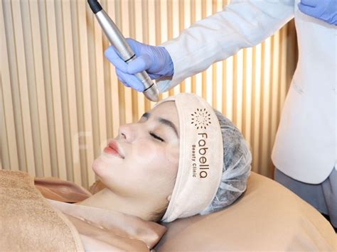 7 Fakta Biaya Laser Muka: Murah vs Mahal, Hasilnya Beda?