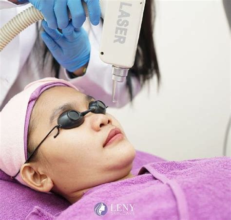 5 Cara Menghemat Harga Perawatan Leny Skincare Hingga 50% untuk Kulit Wajah Mulus! 5 Cara Menghemat Harga Perawatan Leny Skincare Hingga 50% untuk Kulit Wajah Mulus!