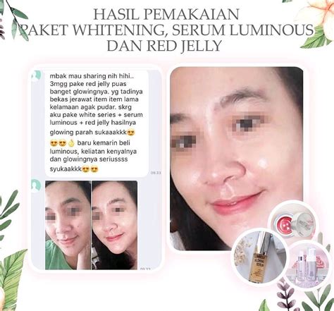5 Cara Perawatan Wajah MS Glow dengan Harga di Bawah Rp500.000 yang Bisa Bikin Wajah Kamu Glowing! 5 Cara Perawatan Wajah MS Glow dengan Harga di Bawah Rp500.000 yang Bisa Bikin Wajah Kamu Glowing!