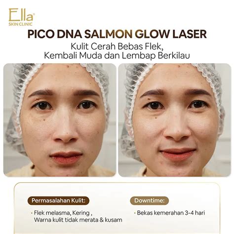 5 Harga Treatment Athena yang Bikin Dompet Tetap Happy! 5 Harga Treatment Athena yang Bikin Dompet Tetap Happy!