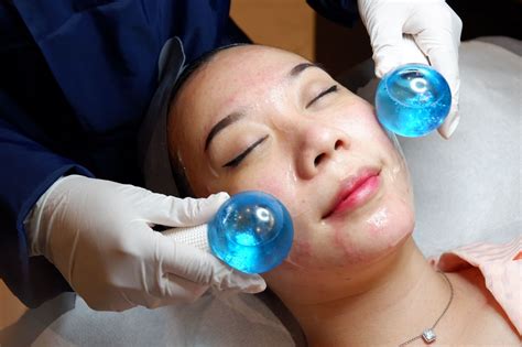 5 Treatment Dermies Termurah: Harga di Bawah 200 Ribu! 5 Treatment Dermies Termurah: Harga di Bawah 200 Ribu!