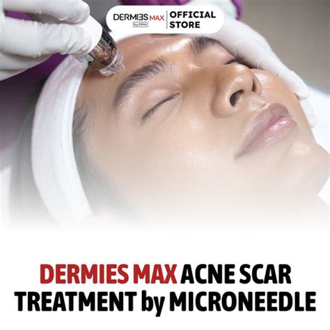 5 Treatment Dermies Termurah: Harga di Bawah 200 Ribu! 5 Treatment Dermies Termurah: Harga di Bawah 200 Ribu!