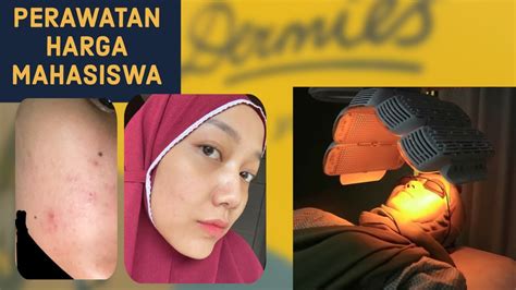 5 Treatment Dermies Termurah: Harga di Bawah 200 Ribu! 5 Treatment Dermies Termurah: Harga di Bawah 200 Ribu!