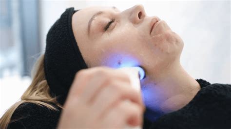 5 Treatment di Dermies dengan Harga di Bawah 200 Ribu: Glowing Tanpa Bikin Boncos! 5 Treatment di Dermies dengan Harga di Bawah 200 Ribu: Glowing Tanpa Bikin Boncos!