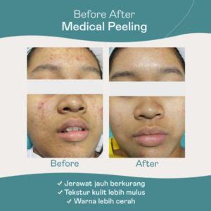 5 Treatment Estetiderma Paling Populer: Bocoran Harga and Hasilnya! 5 Treatment Estetiderma Paling Populer: Bocoran Harga and Hasilnya!