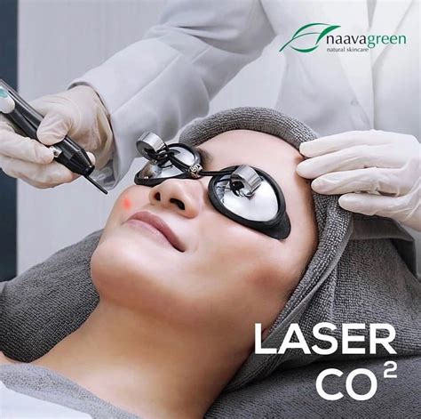 7 Fakta Mengejutkan Harga Laser CO2 di Naavagreen 2022: No. 3 Bikin Dompet Senyum!