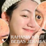 7 Langkah Bye-Bye Jerawat: Kulit Mulus Auto Glowing!