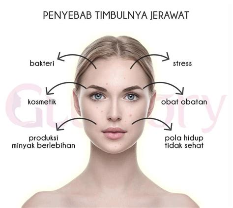 7 Langkah Bye-Bye Jerawat: Kulit Mulus Auto Glowing! 7 Langkah Bye-Bye Jerawat: Kulit Mulus Auto Glowing!