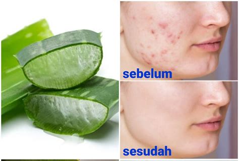 7 Tips Rahasia Kulit Putih Bersih Alami: Rahasia Glowing Sepanjang Masa! 7 Tips Rahasia Kulit Putih Bersih Alami: Rahasia Glowing Sepanjang Masa!