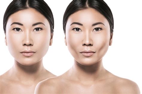 7 Treatment Meniruskan Pipi: Harga Mulai 99 Ribu, Hasilnya Bikin Pangling! 7 Treatment Meniruskan Pipi: Harga Mulai 99 Ribu, Hasilnya Bikin Pangling!