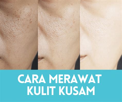 5 Kebiasaan Pagi Biar Muka Gak Kusam Seharian 5 Kebiasaan Pagi Biar Muka Gak Kusam Seharian