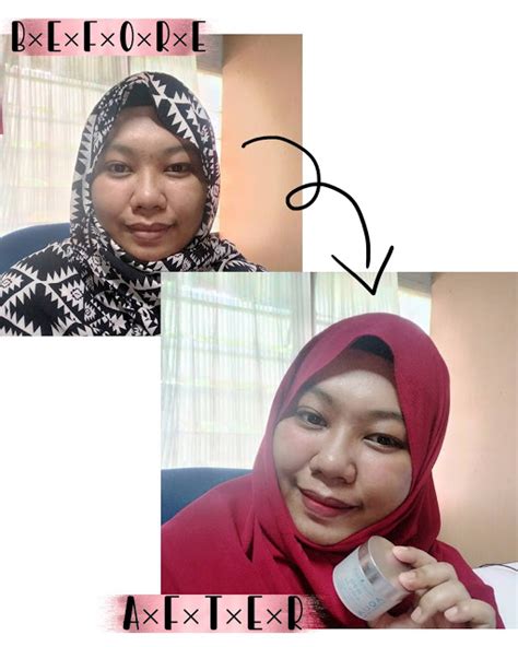 5 Kebiasaan Pagi Biar Muka Gak Kusam Seharian 5 Kebiasaan Pagi Biar Muka Gak Kusam Seharian