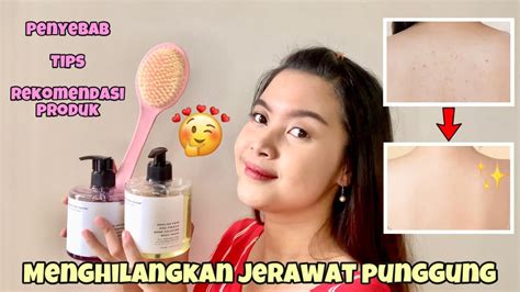 5 Rahasia Ampuh Hilangkan Jerawat Punggung di ZAP: Hasilnya dalam Hitungan Hari! 5 Rahasia Ampuh Hilangkan Jerawat Punggung di ZAP: Hasilnya dalam Hitungan Hari!