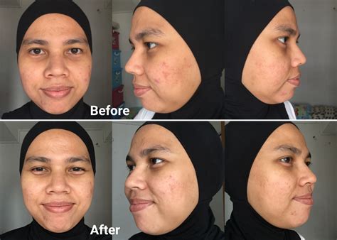 5 Rahasia Glowing Instan: Perawatan Wajib di ERHA! 5 Rahasia Glowing Instan: Perawatan Wajib di ERHA!