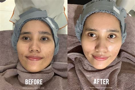5 Rahasia Glowing Instan: Perawatan Wajib di ERHA! 5 Rahasia Glowing Instan: Perawatan Wajib di ERHA!