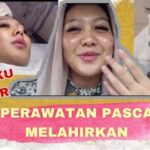 5 Tips Rahasia Perawatan Wajah Pasca Cauter yang Bikin Kulit Mulus Kilat!