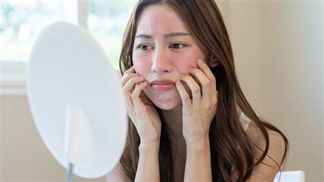 5 Tips Rahasia Perawatan Wajah Pasca Cauter yang Bikin Kulit Mulus Kilat! 5 Tips Rahasia Perawatan Wajah Pasca Cauter yang Bikin Kulit Mulus Kilat!
