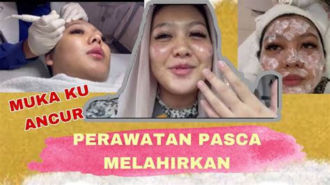 5 Tips Rahasia Perawatan Wajah Pasca Cauter yang Bikin Kulit Mulus Kilat! 5 Tips Rahasia Perawatan Wajah Pasca Cauter yang Bikin Kulit Mulus Kilat!