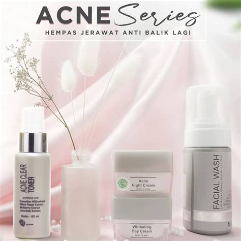 7 Cara Paket MS Glow Menghilangkan Jerawat dan Merawat Kulit dalam 1 Minggu! 7 Cara Paket MS Glow Menghilangkan Jerawat dan Merawat Kulit dalam 1 Minggu!