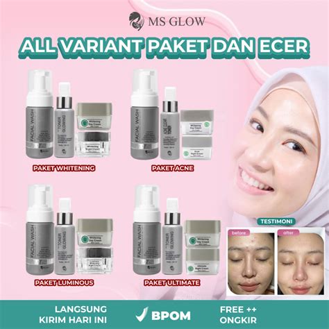 7 Cara Paket MS Glow Menghilangkan Jerawat dan Merawat Kulit dalam 1 Minggu! 7 Cara Paket MS Glow Menghilangkan Jerawat dan Merawat Kulit dalam 1 Minggu!