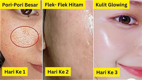 7 Keajaiban Peeling Naavagreen: Kulit Kinclong Instan! 7 Keajaiban Peeling Naavagreen: Kulit Kinclong Instan!