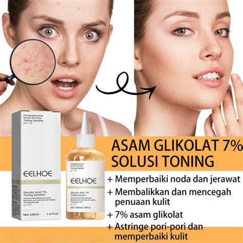 7 Pemutih Wajah Ampuh Basmi Jerawat and Bekasnya, Buktikan Sendiri! 7 Pemutih Wajah Ampuh Basmi Jerawat and Bekasnya, Buktikan Sendiri!