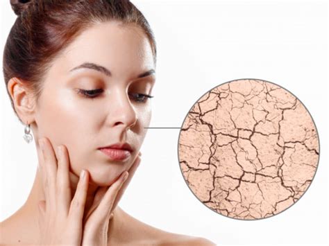 7 Rahasia Kulit Glowing Bebas Kering and Kusam dengan Bahan Alami! 7 Rahasia Kulit Glowing Bebas Kering and Kusam dengan Bahan Alami!