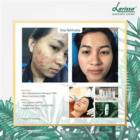 7 Rahasia Perawatan Badan di Larissa yang Bikin Kulit Glowing dalam 7 Hari! 7 Rahasia Perawatan Badan di Larissa yang Bikin Kulit Glowing dalam 7 Hari!