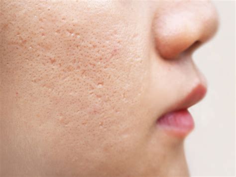 7 Treatment Wajah Ala Korea yang Bikin Kulit Maksimal Lembut and Bercahaya 7 Treatment Wajah Ala Korea yang Bikin Kulit Maksimal Lembut and Bercahaya